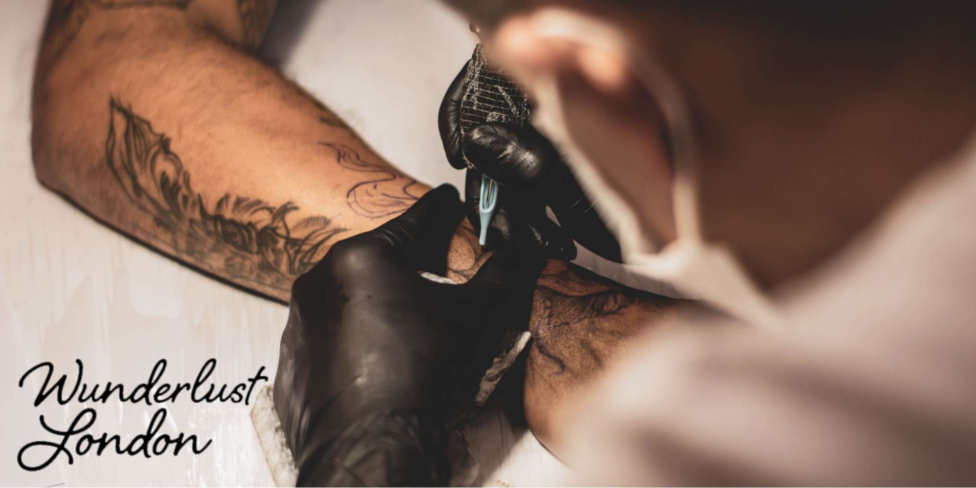 Tattoo Removal London | Tattoo Removal Experts