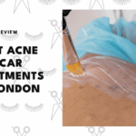 best-acne-scar-treatments-london
