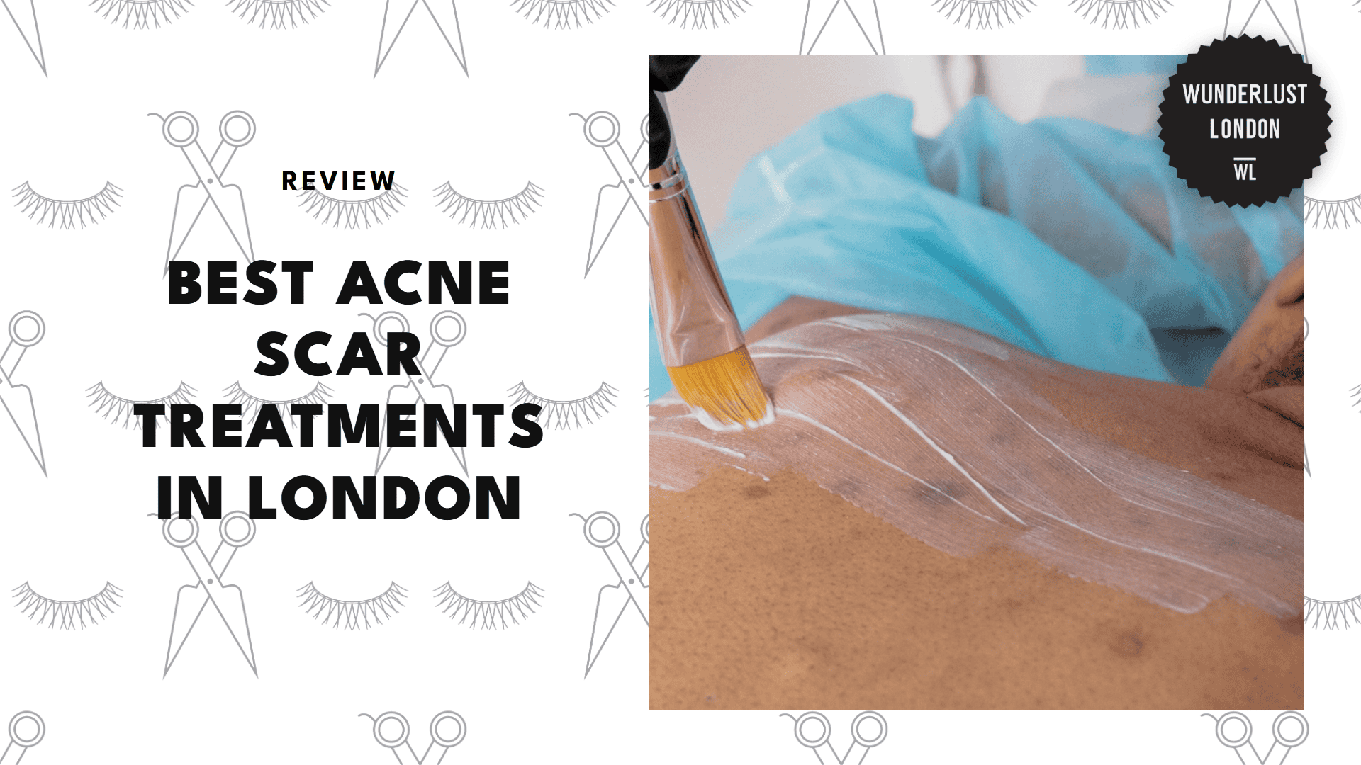 best-acne-scar-treatments-london